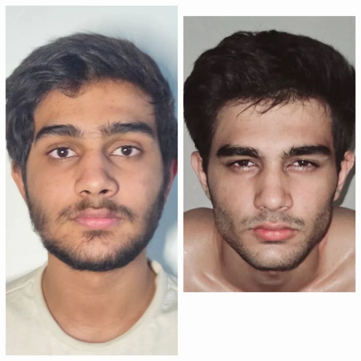 Front-facing before and after 36 weeks of body recomposition
